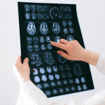 Descubra com a Dra. Thaline Neves como a radiologia intervencionista ambulatorial oferece soluções menos invasivas e altamente resolutivas.