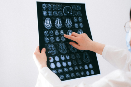 Descubra com a Dra. Thaline Neves como a radiologia intervencionista ambulatorial oferece soluções menos invasivas e altamente resolutivas.