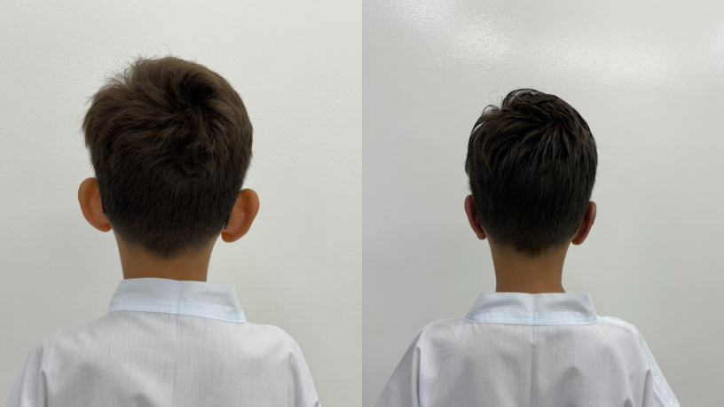 A evolução dos procedimentos minimamente invasivos torna o futuro da cirurgia plástica mais seguro e moderno, observa Milton Seigi Hayashi.